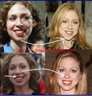 They should really look into getting their money back from the plastic surgeon.