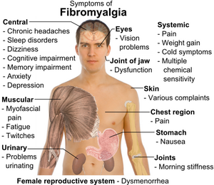 Symptoms of fibromyalgia.png