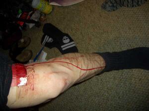 Emo Girl Cuts Herself Picture-115.jpg