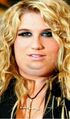 What Ke$ha will look like in 6 months.