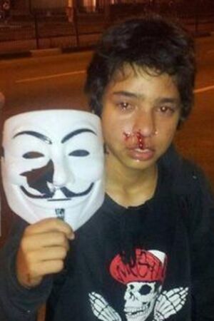 Brokennose cancerousmaskfag kid.jpg