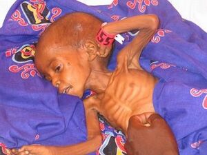 Darfur child starving.jpg