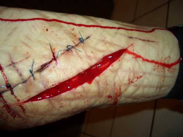 File:Emo Girl Cuts Herself Picture-127.jpg