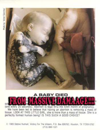 File:MASSIVEBABY.jpg