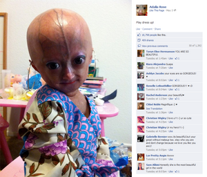 Adalia Rose - LIES.png