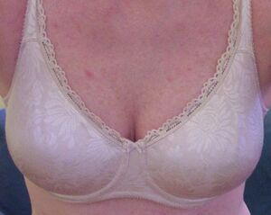 CleavageEnhancementStep3BeforeMakeup.JPG