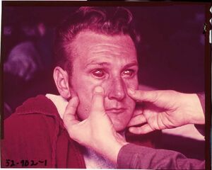 Ebola virus eyes.jpg